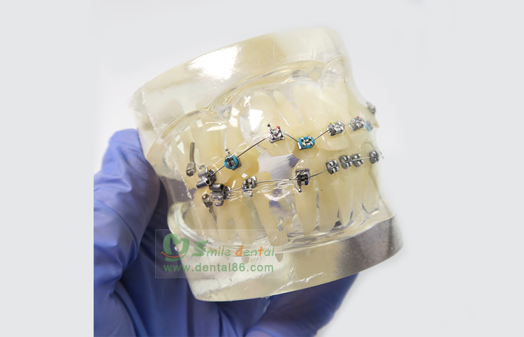 TM-B2-01 Orthodontic Model